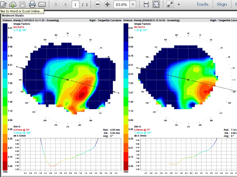 Right eye top comparison