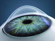 Corneal Cross Linking